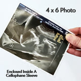 Pretend Reborn Ultrasound / Sonogram Photo For Reborn OR Silicone Baby Dolls!