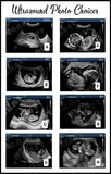 Pretend Reborn Ultrasound / Sonogram Photo For Reborn OR Silicone Baby Dolls!